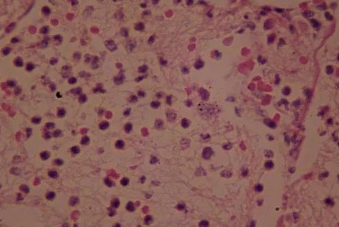 �����轵��������������к�����ð��