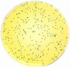 �Ʊ��ϸ��΢���������������ɺ��Ե�ע������