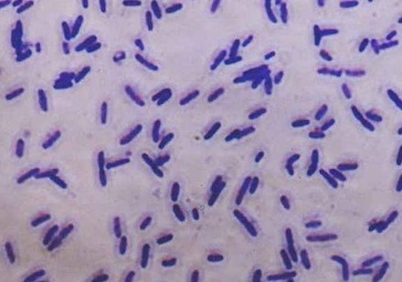 �ݲ�ѿ�߸˾���ǰ������