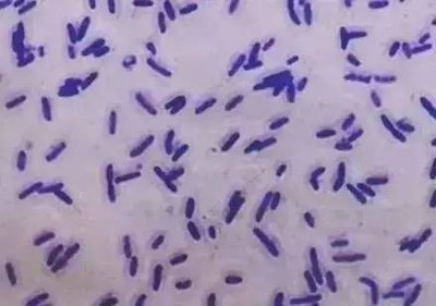 ѿ�߸˾��������õĺã�