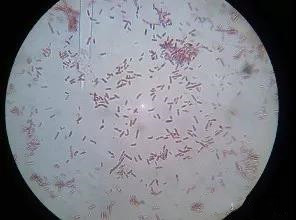 ����Ϊʲô�����ӡ��ݲ�ѿ�߸˾���